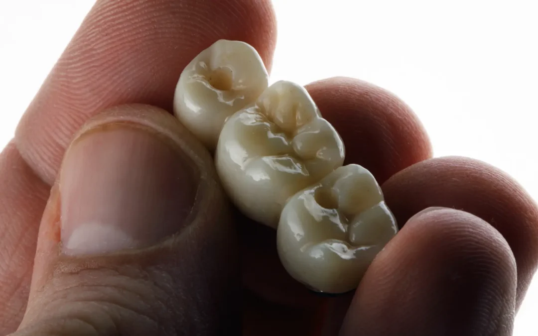 Beyond Crowns: How CAD/CAM Technology is Transforming Dental Bridges and Restorations