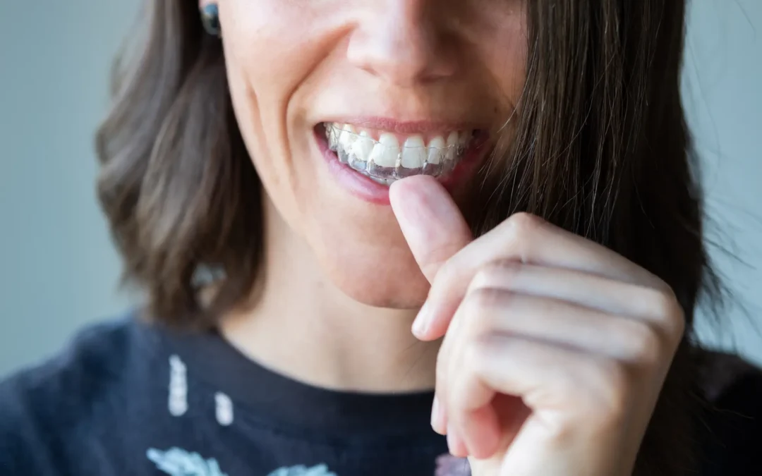 SureSmile vs. Invisalign: Which Clear Aligner is Better for Complex Bites?